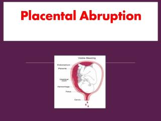 2- Placental abruption.ppt